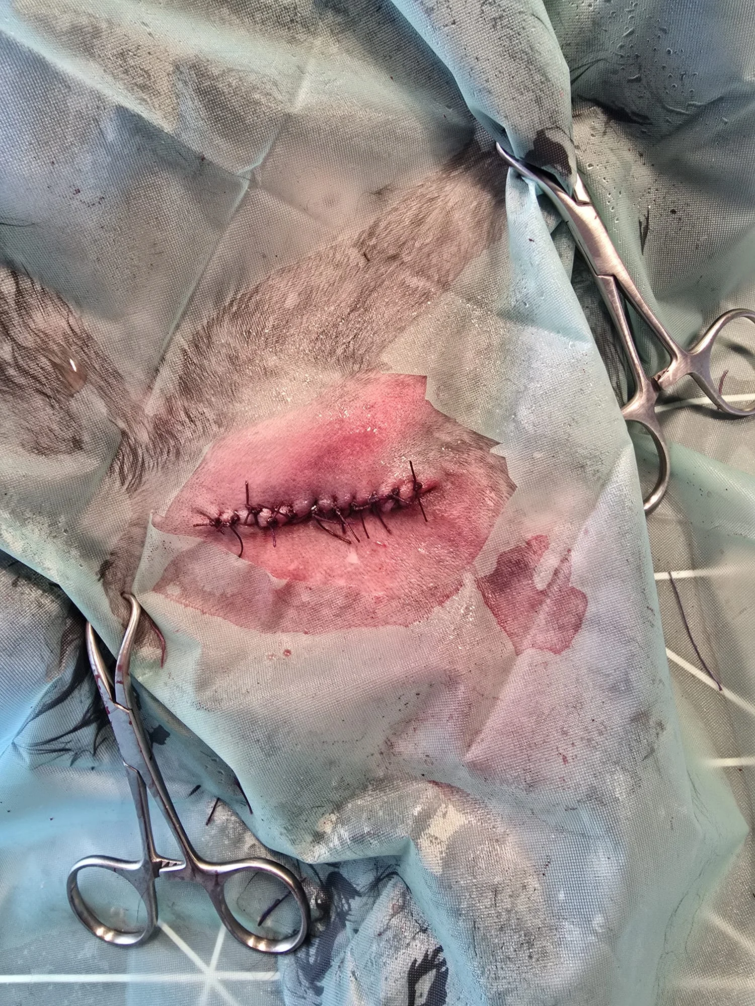 Wundversorgung Schritt 2 - Reinigung